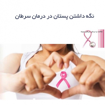 نگه داشتن پستان در درمان سرطان