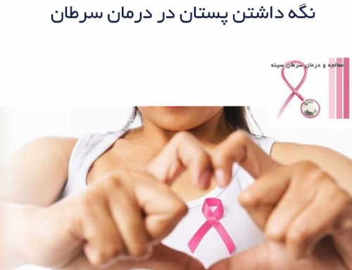 نگه داشتن پستان در درمان سرطان