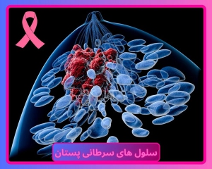 سلول های سرطانی در سینه