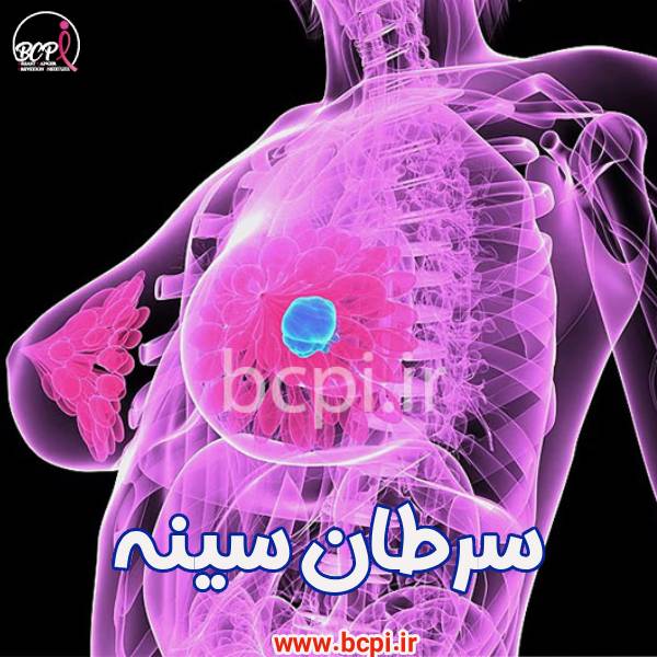 سرطان سینه - مرکز bcpi
