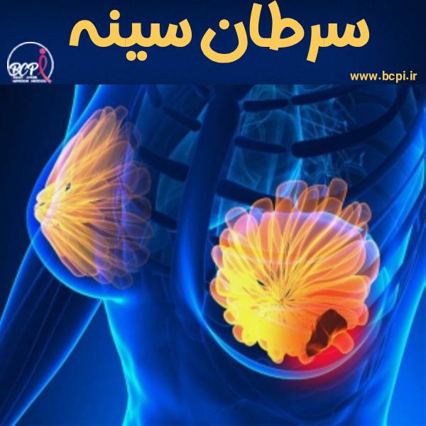 سرطان سینه - خیریه bcpi