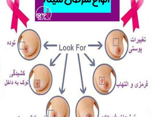انواع سرطان سينه | آیا سرطان سینه درمان می شود؟
