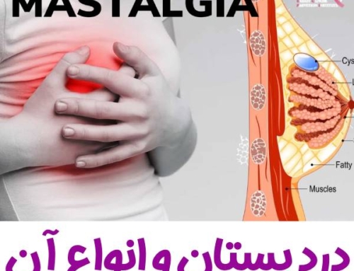 درد پستان + انواع درد دوره ای و غیر دوره ای
