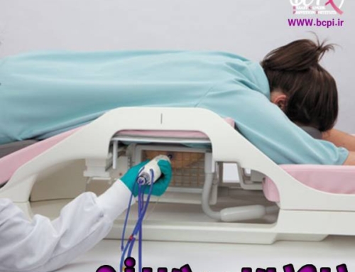 بیوپسی سینه + عوارض