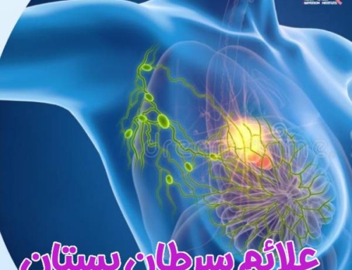 علائم سرطان پستان + فیلم توضیحات دکتر هادیزاده