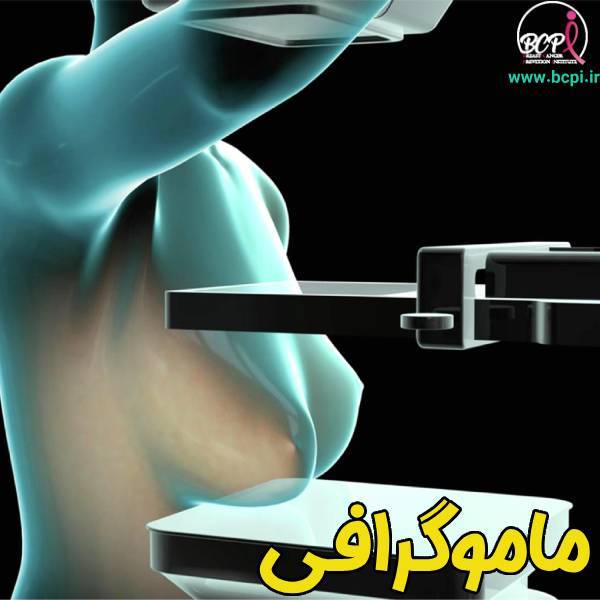 ماموگرافی - موسسه خیریه bcpi