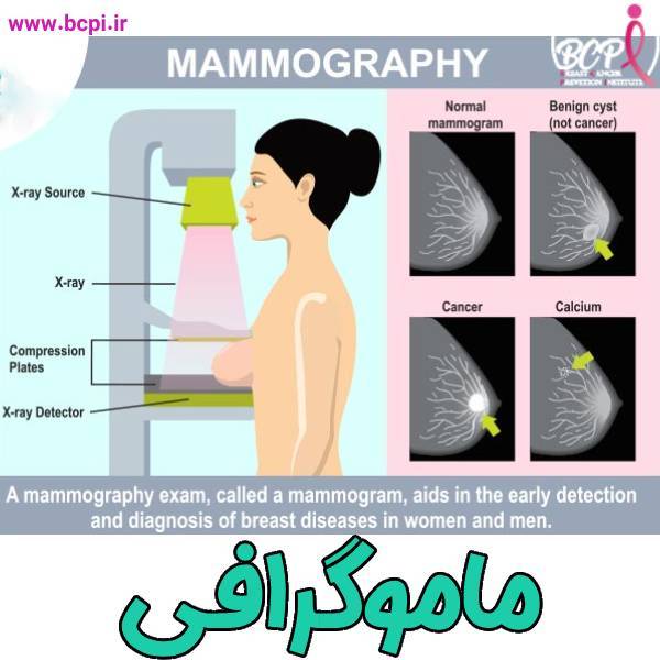 ماموگرافی - موسسه خیریه bcpi